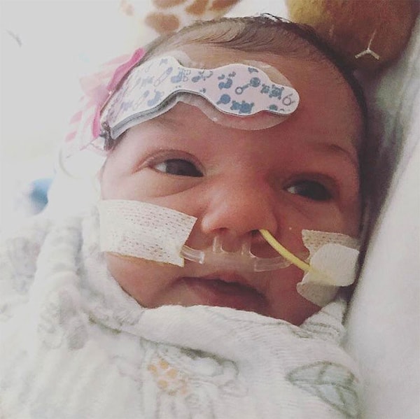 6. Необходимо было убрать трубки и бинты с лица младенца