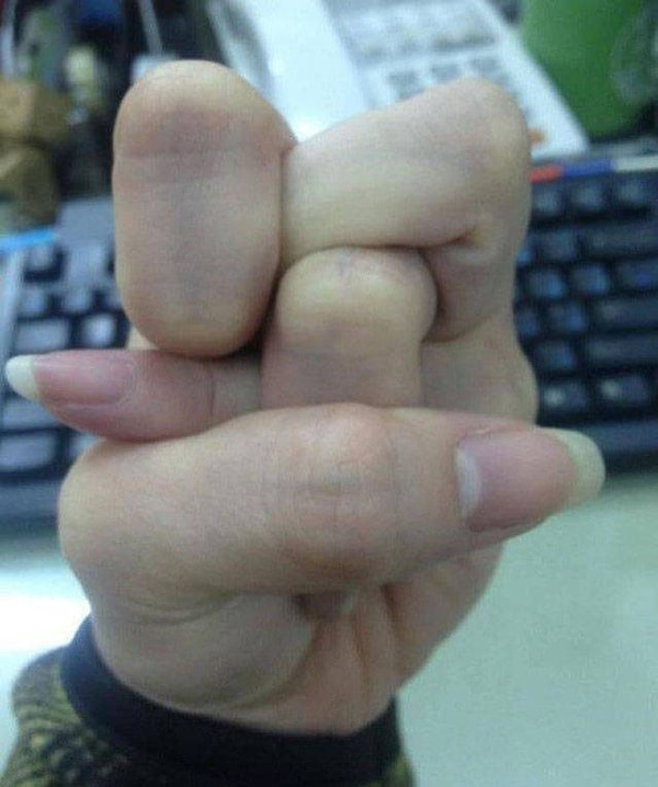 19. - А еще я могу дотянуться большим пальцем до предплечья. - Ок, подержи мое пиво еще раз.