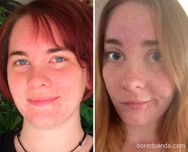 22. 6 месяцев трезвости.