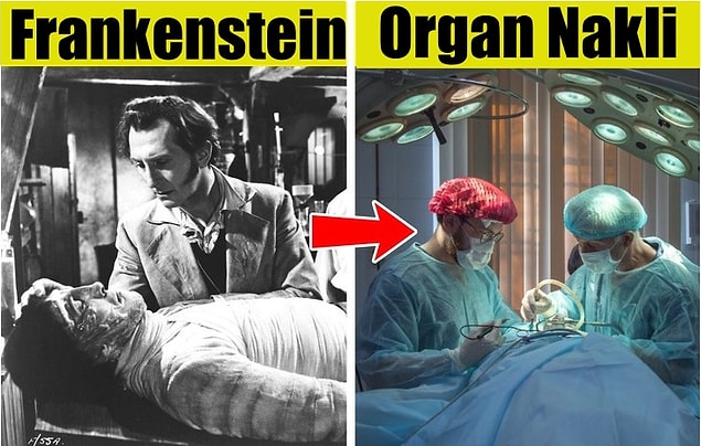 4. Organ ve doku nakli