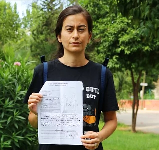 Darp raporu alıp karakola şikayetçi oldu