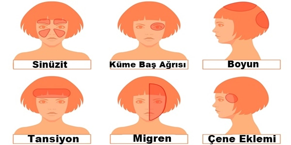 Baş Ağrınızın Nedenini Ağrıdığı Yere Göre Tespit Edebileceğinizi Biliyor muydunuz?