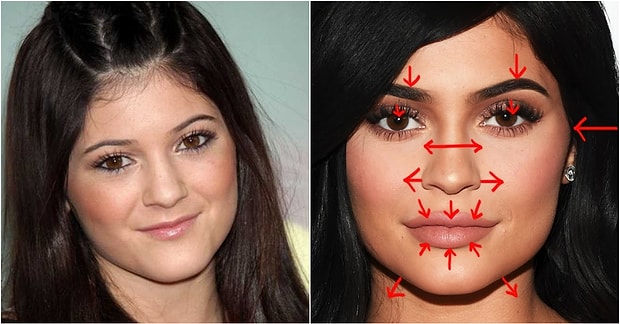 Estetik Ameliyat Gecirdigini Inkar Eden 19 Unlu Ismin Hangi Islemleri Yaptirdigini Tek Tek Ortaya Dokuyoruz Estetik Ameliyat Gecirdigini Inkar Eden 19 Unlu Ismin Hangi Islemleri Yaptirdigini Tek Tek Ortaya Dokuyoruz