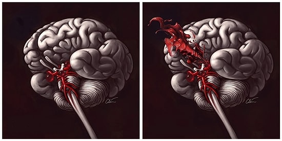 Günlük Hayatta Yaşadığınız Bazı Problemlerin Hafıza Kaybına Yol Açabileceğini Biliyor muydunuz?