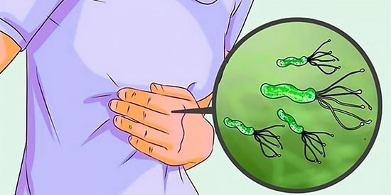 Vücudunuzda Sinsice İlerleyip Bazı Ciddi Hastalıklara Neden Olabilecek Helicobacter Pylori Hakkında Mutlaka Bilmeniz Gerekenler