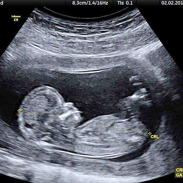 1. Justin Bieber, 1 Nisan şakası amaçlı sahte bir hamilelik haberi paylaşmıştı ama...
