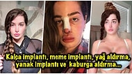 Çuvallarca Para Döktüğü Operasyonlara Ailesinin Tüm Endişelerine Rağmen Devam Eden Estetik Bağımlısı Kadın