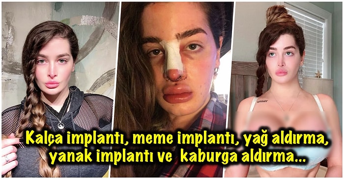 Çuvallarca Para Döktüğü Operasyonlara Ailesinin Tüm Endişelerine Rağmen Devam Eden Estetik Bağımlısı Kadın