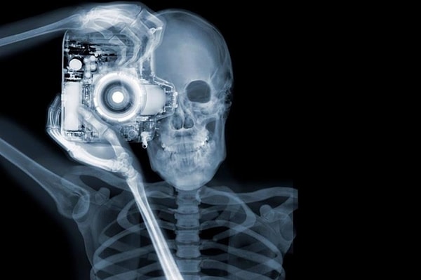 4. Рентгеновские лучи называют буквой...