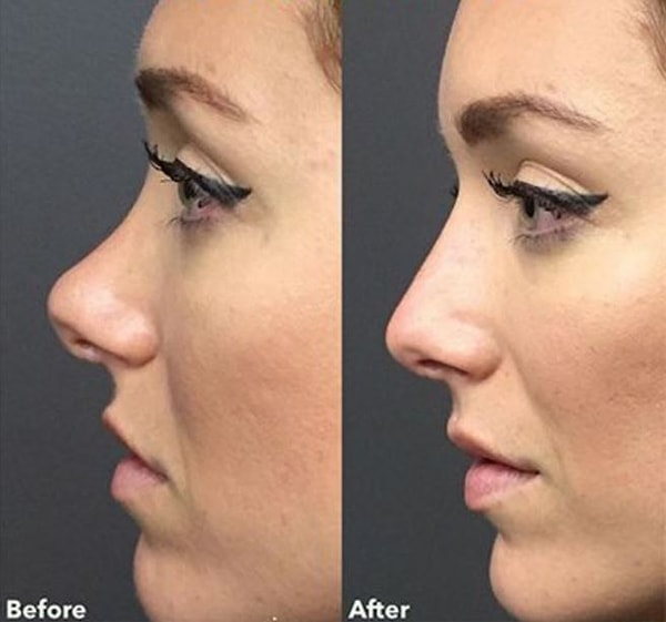 Как видите, мода прошла.