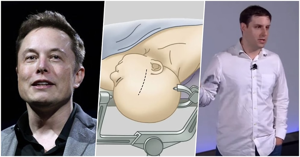 Dur Durak Bilmiyor! Elon Musk İnsan Beynini Kontrol Edebileceğini Düşünüyor