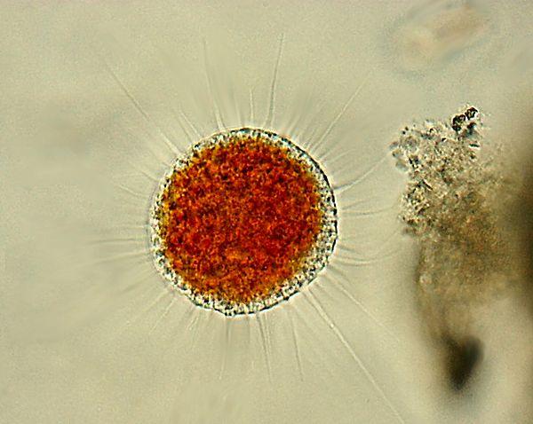 12. Vampyrellid Amoeba isimli bu mikroskobik canlılar, deniz yosuna bir delik oluştururlar ve dokunaçlarını kullanarak bütün özü emerler.
