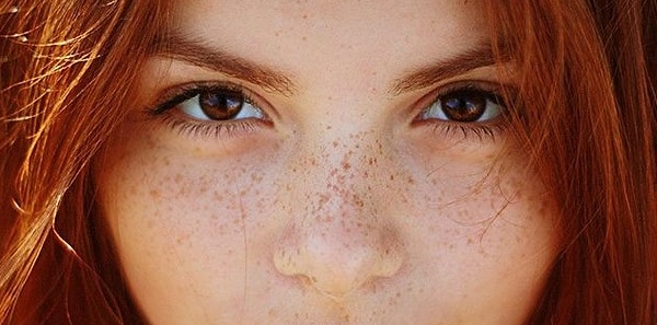 10. И, наконец, у вас есть веснушки?