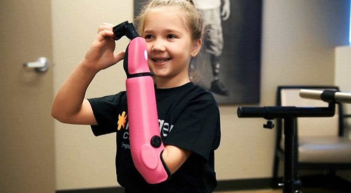 Hayata Biyonik Kolla Tutundu: Artık İki Eliyle Kalp Yapabiliyor!