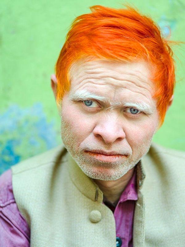 1. Hindistan'da bir albino