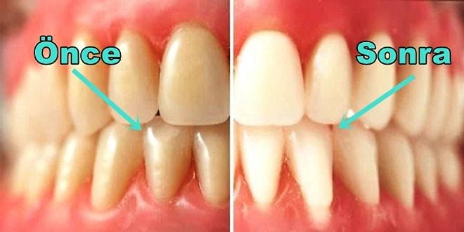 Sağlıklı Dişler ve Çok Daha Güzel Bir Gülüş İçin Hemen Uygulamaya Başlamanız Gereken 11 Alışkanlık