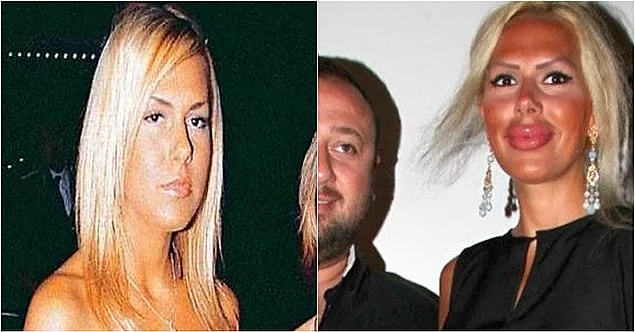 10. Hande Acar sadece dudaklarında estetik olduğunu söylese de durumun vahimliği ortada sanki...
