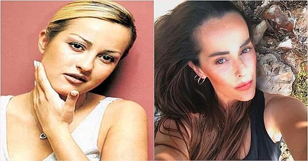11. Helin Avşar, "Estetik yaptırmışa mı benziyorum" diyerek inkar etse de çenesindeki değişimi fark etmemek mümkün değil.