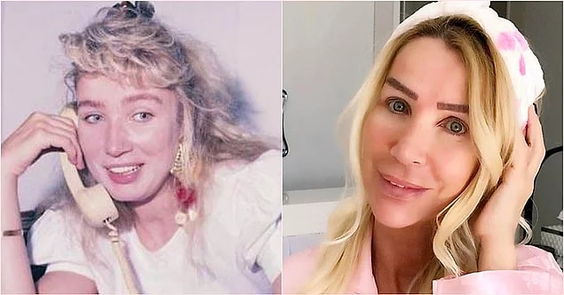 19. Seda Sayan yaptırdığı estetiklerden dolayı resmen başka birine dönüştü.