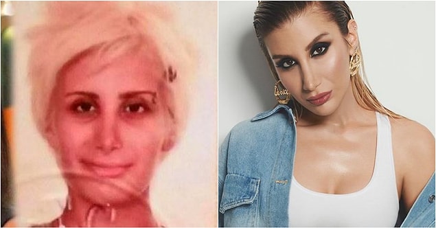 8. Defalarca estetik ameliyat geçiren İrem Derici, gerçekten ne kadar da çok değişmiş.