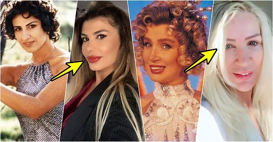 Yaptırdıkları Yanlış Operasyonlar Yüzünden Bambaşka Bir İnsana Dönüşen Estetik Mağduru 19 Ünlü İsim