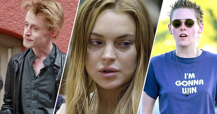 15 знаменитостей, на внешности которых слава сказалась негативно