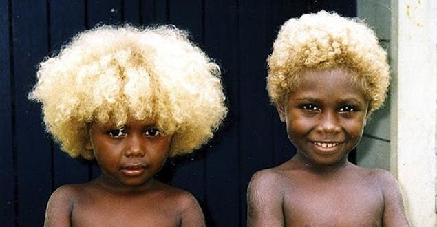 Solomon Adaları'nın, Melanezya halkı Avrupa dışında sarı saçlı nadir görülen birkaç gruptan biri.