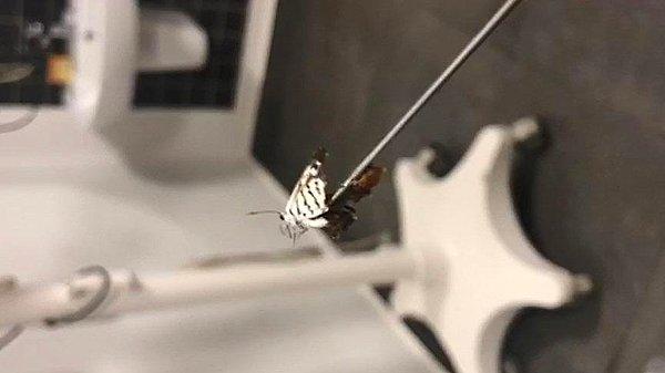 Yapılan muayenede Gök'ün sağ kulağında kelebek olduğu görüldü. Mikro kamerayla kulağın içini kontrol eden doktor, kelebeğin canlı olduğunu ve kanat çırptığını tespit etti.