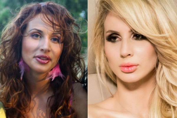 7. Суперзвезда Светлана Лобода тоже утверждает, что не прибегала к помощи пластических хирургов. Верить ей или нет, решать вам.