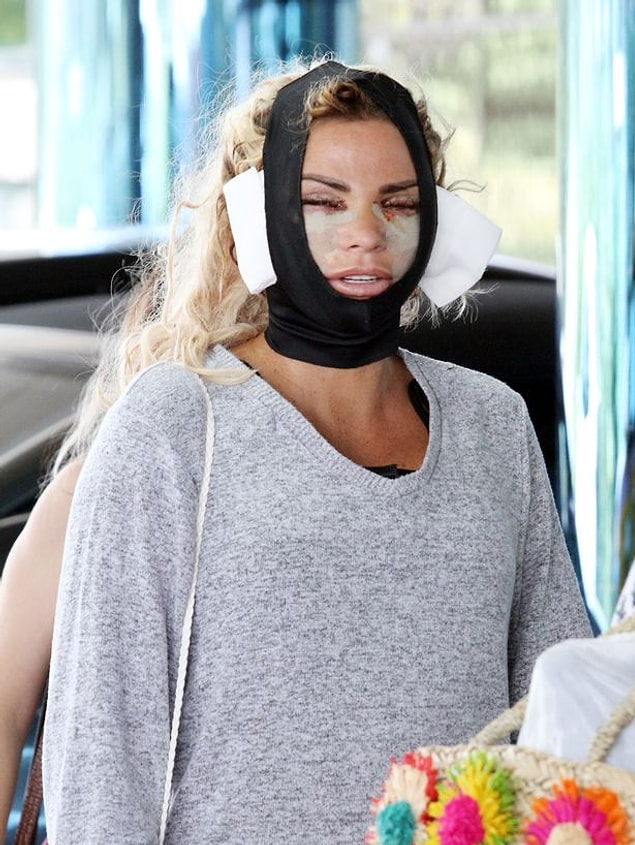 İddialara göre Bodrum'da bir klinikte estetik operasyonu geçiren Price, bandajlı görüntüsü ile görenleri korkuttu.