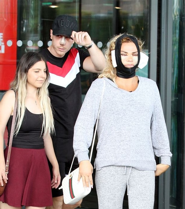 Operasyonun ardından nişanlısı ile klinikten ayrılan Katie Price'ın yüzü tanınmayacak haldeydi.