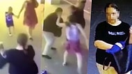 Vahşetin Böylesi! Ailesiyle Birlikte Yolda Yürüyen 3 Yaşındaki Çocuğu Rastgele Yüzünden Bıçaklayan Kadın
