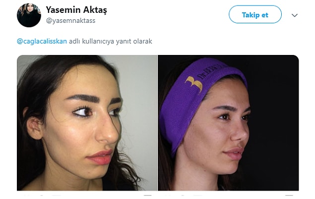 21.