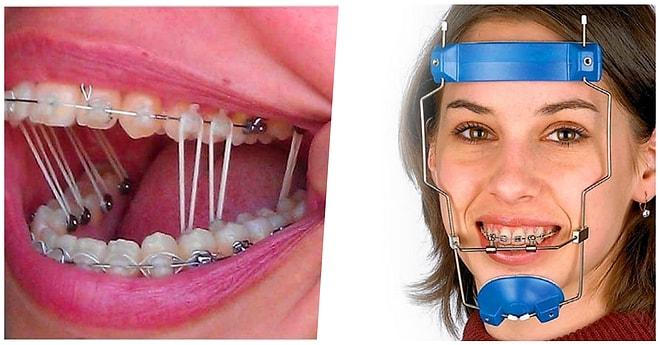 Mükemmel Dişlerle Büyümeyen Diş Telli Çocukların Izdırabını Derinden Hissedeceği 22 Fotoğraf