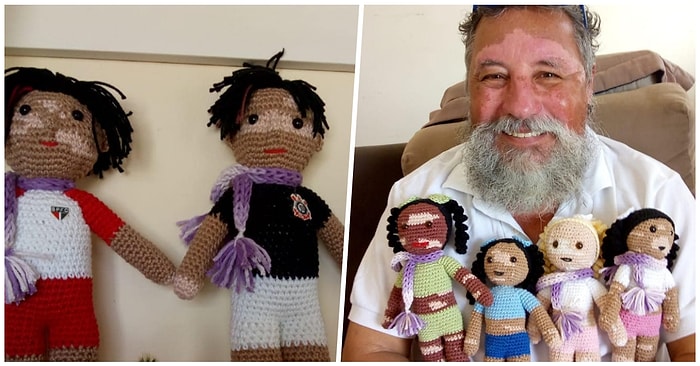 Vitiligo Hastası Çocuklara Öz Güven Aşılamak Amacıyla Tığ ile Oyuncaklar Ören Düşünceli Yaşlı Adam