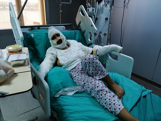 İstanbul'da Vahşet: Cezaevinden İzinli Çıkan Saldırgan, Eski Eşini Önce Bıçakladı Ardından Kızgın Yağ ile Yaktı