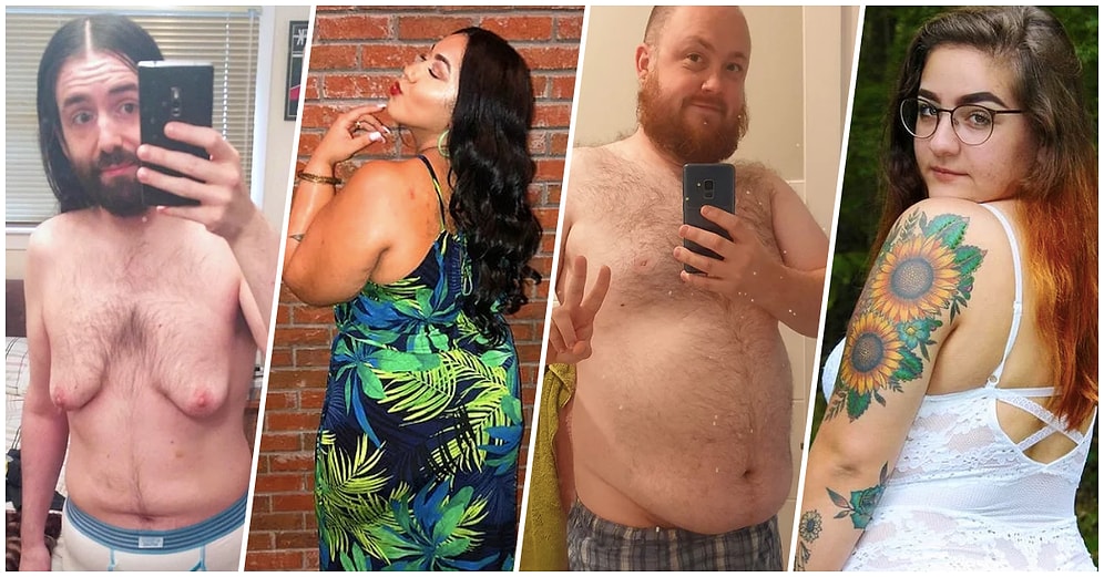 Bedenlerini Olduğu Gibi Sevmeyi Öğrenip İlham Kaynağı Olmak İçin Fotoğraflarını 'Korkusuzca' Paylaşan 21 Kişi