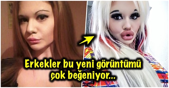Evlilik Teklifleri Yağıyor! Her Geçen Gün Daha da Büyük Dudaklara Sahip Olmak İçin 15 Ameliyat Geçiren Kadın