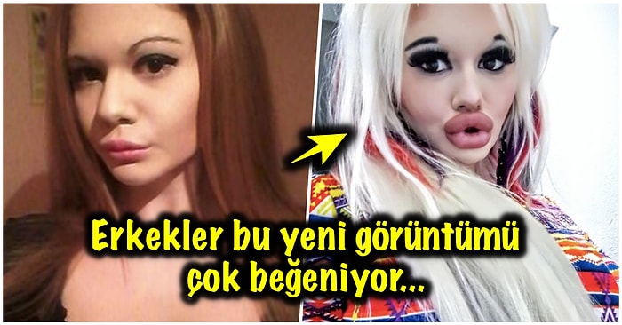 Evlilik Teklifleri Yağıyor! Her Geçen Gün Daha da Büyük Dudaklara Sahip Olmak İçin 15 Ameliyat Geçiren Kadın