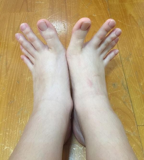 20. Kim demiş ayak parmağı yüzüklerinin modası geçti diye?