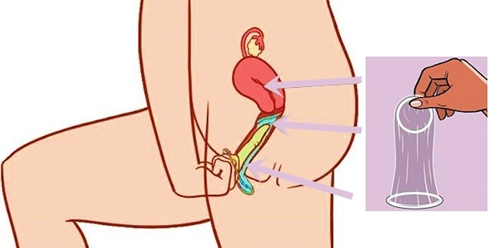 Kadınların En Güçlü Silahı "Kadın Prezervatifi" Hakkında Mutlaka Bilmeniz Gerekenler