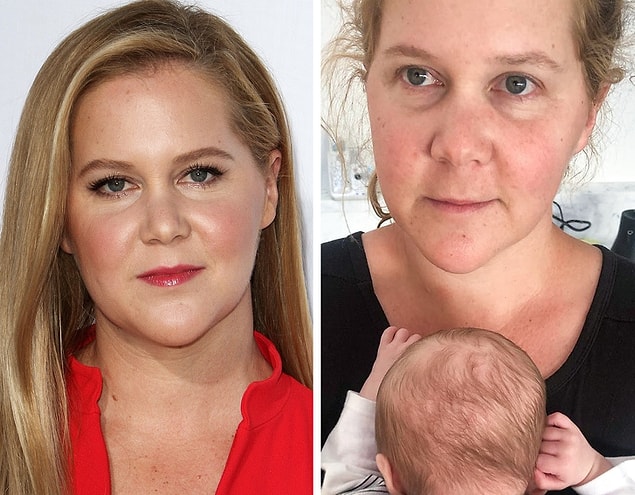 12. Amy Schumer