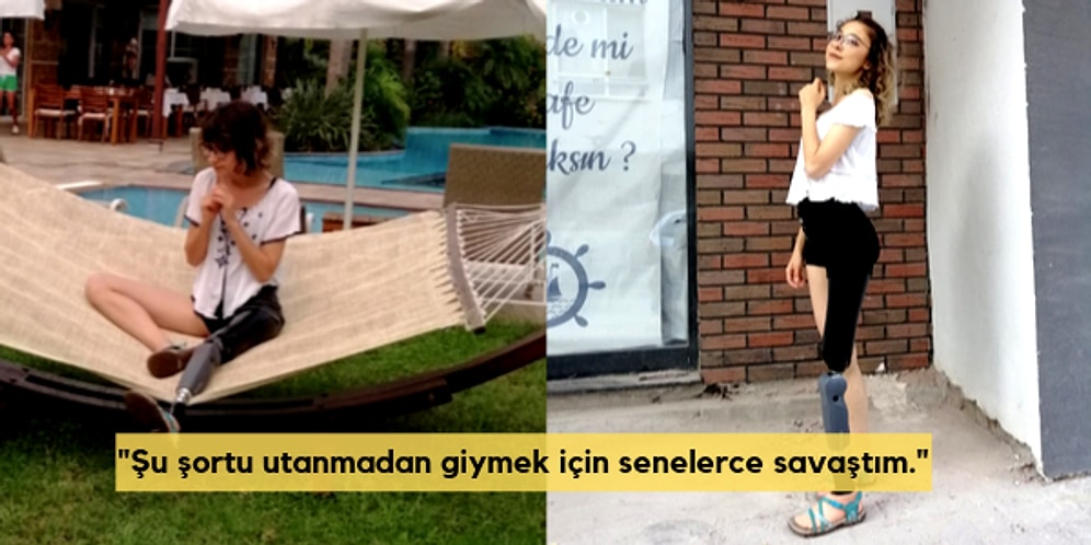 O Şampiyonluk Kazanmadı Ama Kendini Kazandı! Bacağındaki Protezle İlk Defa 'Utanmadan' Şort Giyen Genç Kızın Yaşadıkları
