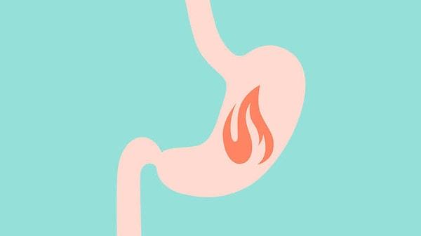 Genellikle, midedeki asitlik gastroözofageal reflü hastalığının bir sonucudur. Midedeki yiyecekler yemek borusuna geri döndüğünde oluşur. Bu da yanma, ekşime hissine neden olur.