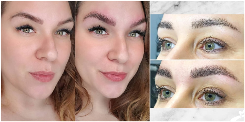 Bıçak Yok, İğne Yok: Her An Baş Döndüren Dolgun Kaşlar İsteyenlerin Yeni Trendi Kaş Lifting Nedir?