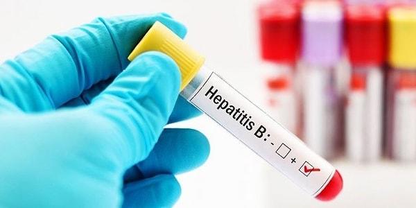 1984 - Hepatit virüsü bulundu.