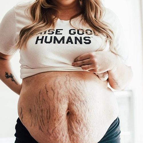Hamilelikte Vücutlarında Oluşan Çatlaklar ile Poz Veren Kadınları Görünce Anne Olmadan Önce Bir Kez Daha Düşüneceksiniz! - onedio.com