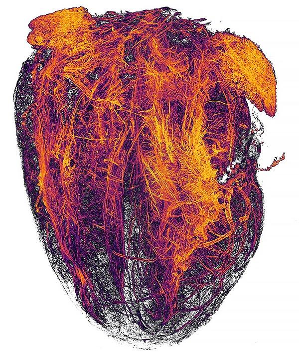 20. Kalp krizi geçiren bir farenin kalbindeki kan damarları
