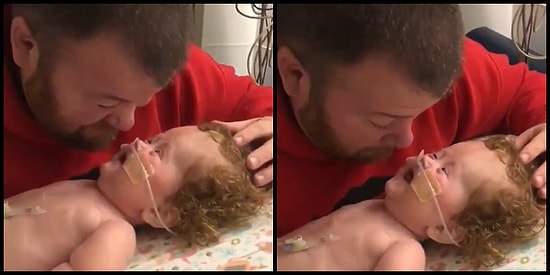 Hastanede Yatan Minik Kızını Neşelendiren Tatlış Baba