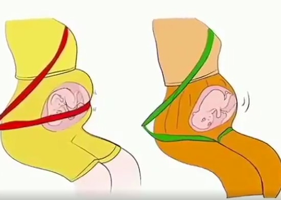 Hamile Kadınlar İçin Hayat Kurtarıcı Emniyet Kemeri Takma Taktiği